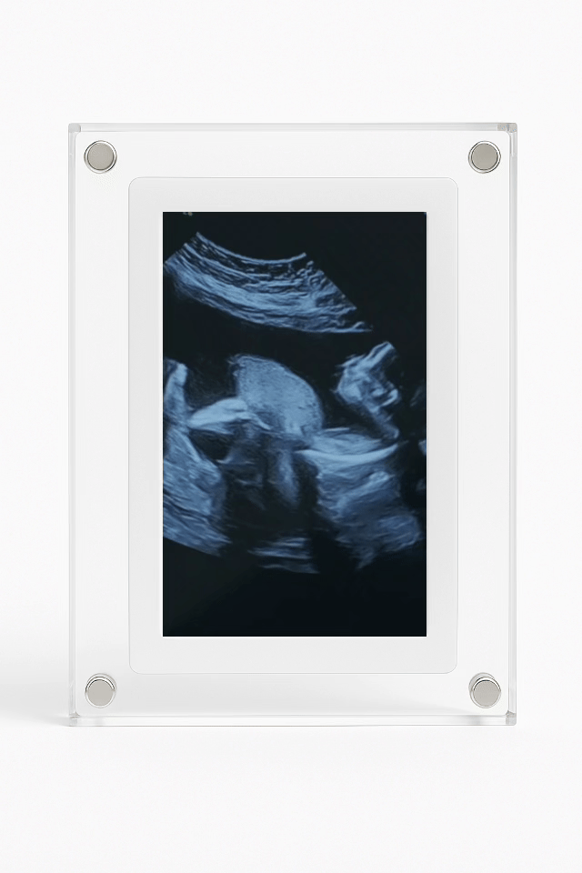 Pilaxo™ Baby Memory Frame