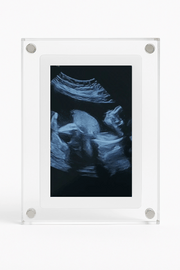 Pilaxo™ Baby Memory Frame